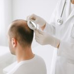 Evaluación de un trasplante capilar